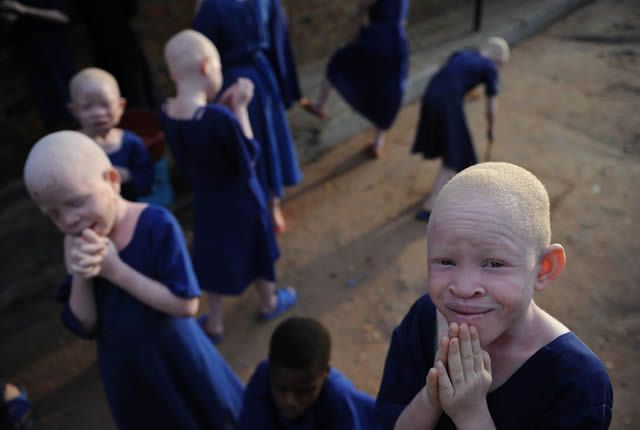 Escolares albinos de régimen interno en Tanzania.